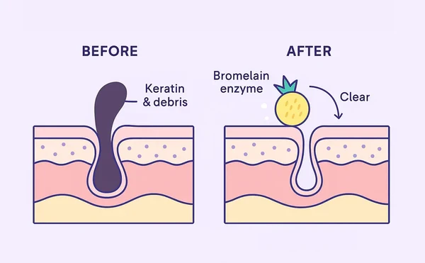 Bromelain Benefits For Skin Bromelain Benefits For Skin